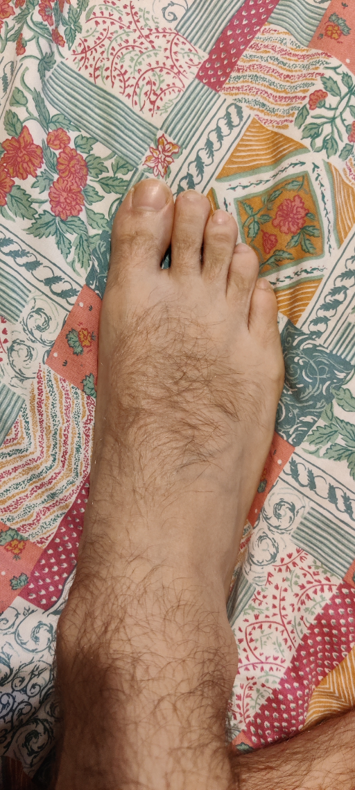 PP - Hairy Feet