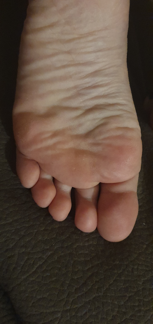 Sweet Feet